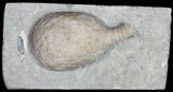 Huge, D Cystoid (Holocystites) From Indiana #11464-3